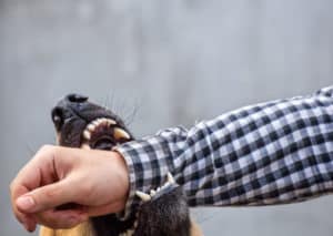 How M&Y Personal Injury Lawyers Can Help With a Dog Bite Claim in Los Angeles