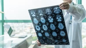 Who Will Treat My Traumatic Brain Injury?