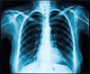 What Is a Thorax?